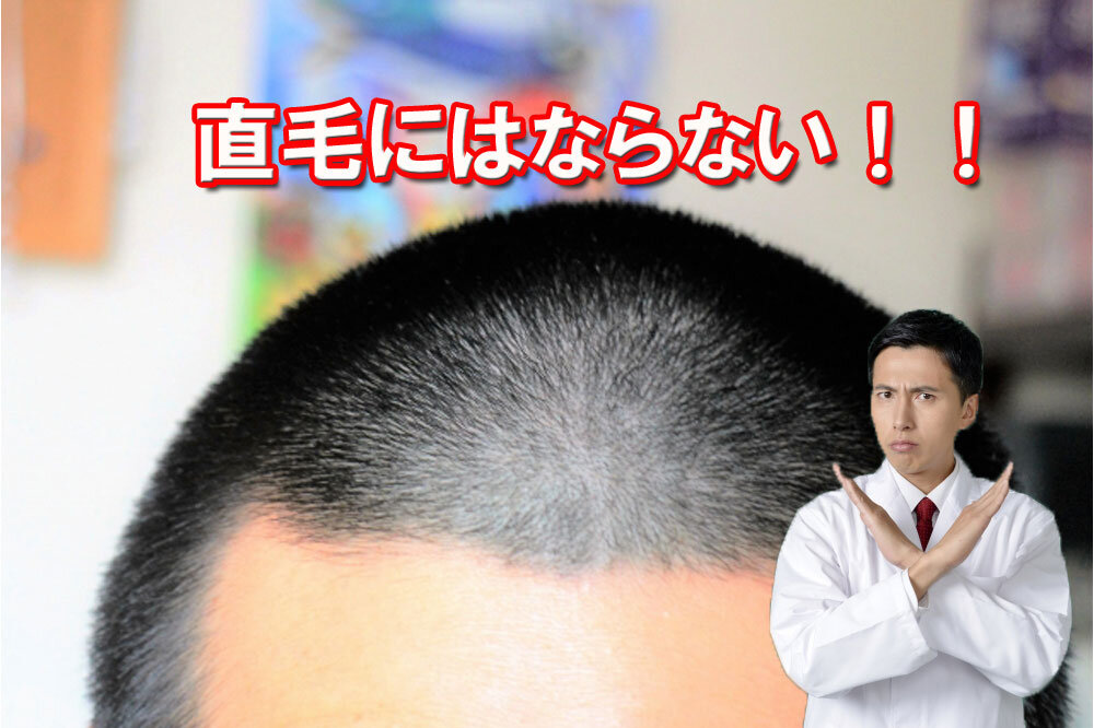 坊主にしても髪質は変わらないと説明する男性