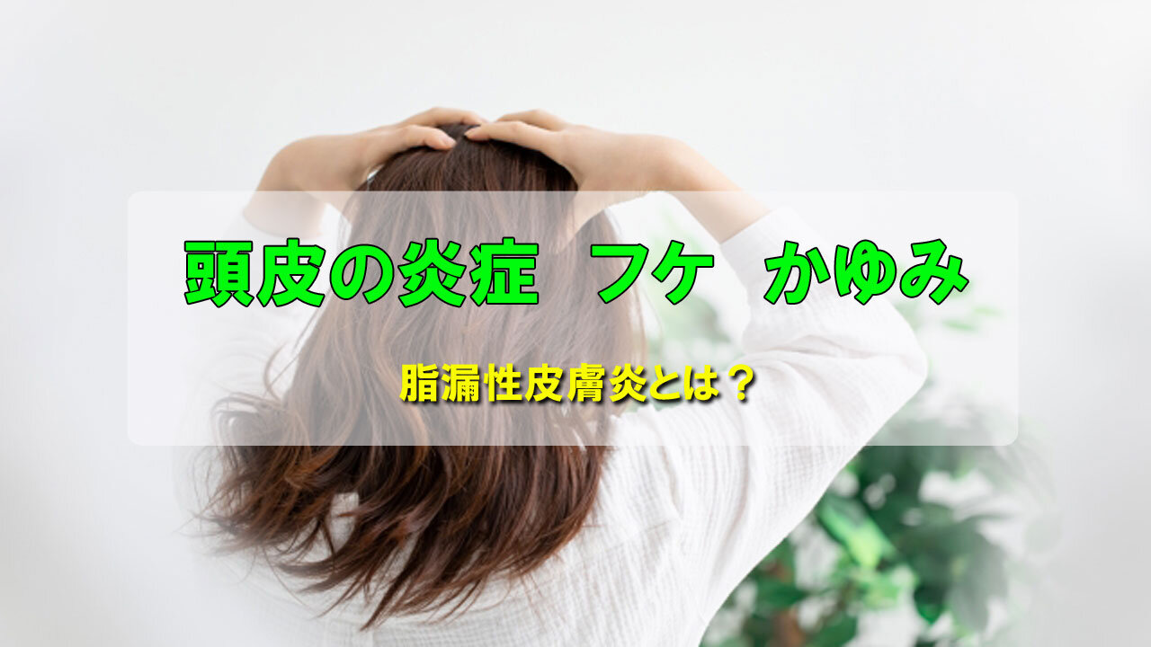 頭がかゆくてかく女性