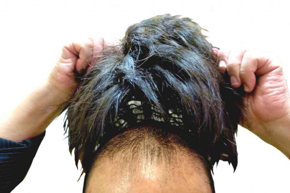 薄毛の男性