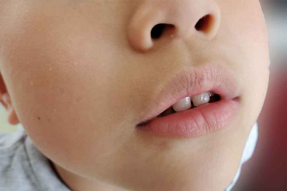 子供の髭をうぶ毛シェーバーで剃る