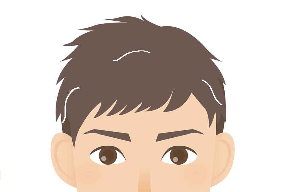 30代前半男性の白髪