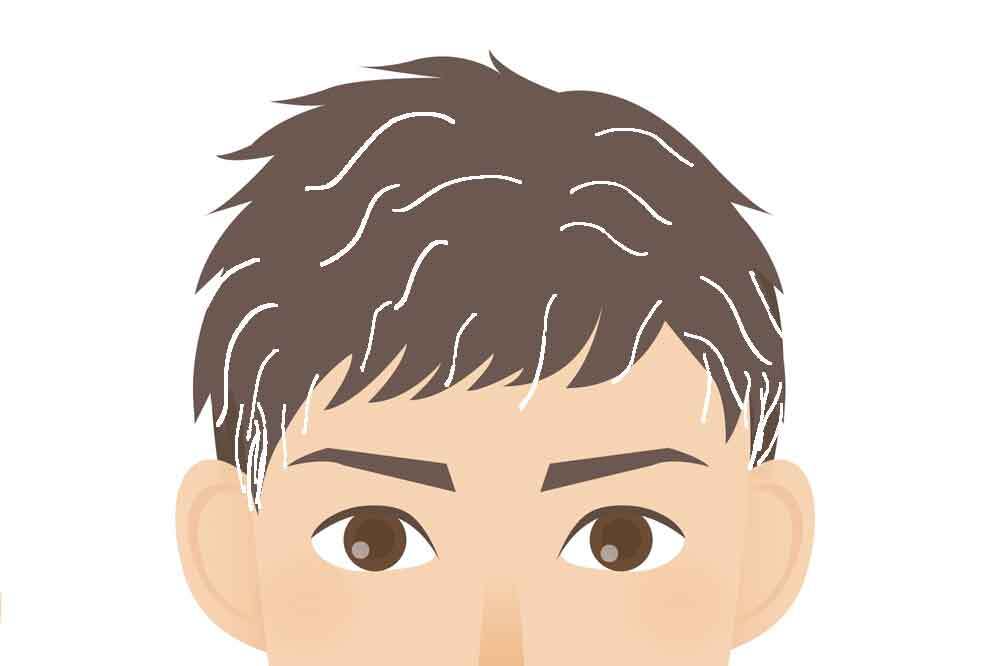 40代前半男性の白髪