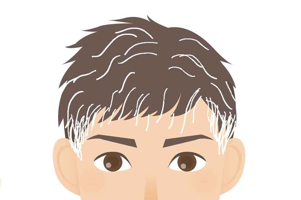 40代後半男性の白髪