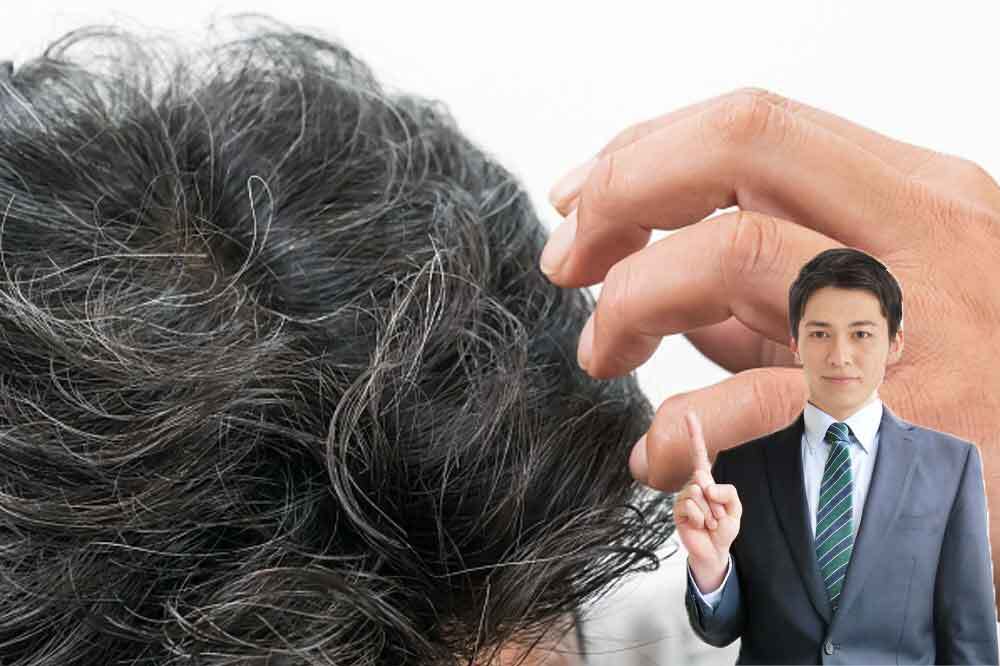 若白髪でもハゲることはある