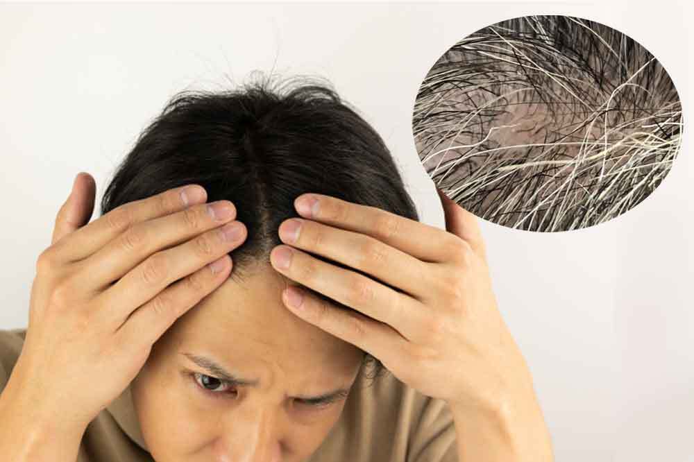 白髪と薄毛を気にする男性