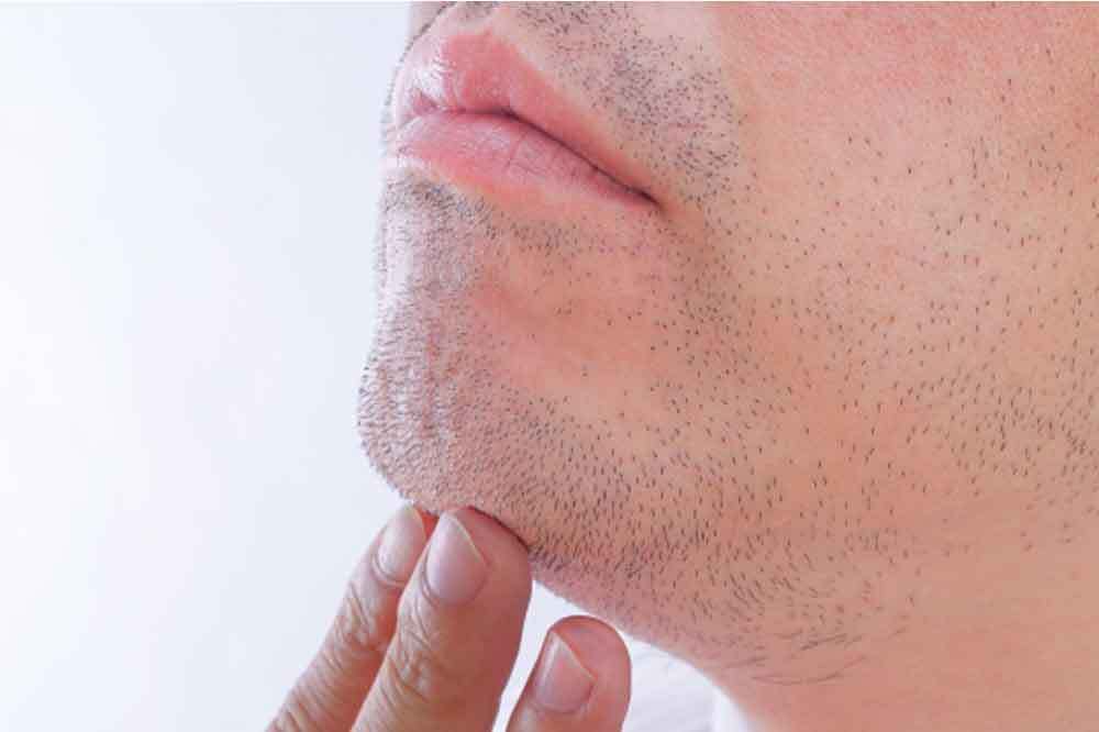ヒゲが濃くなり気になる男性